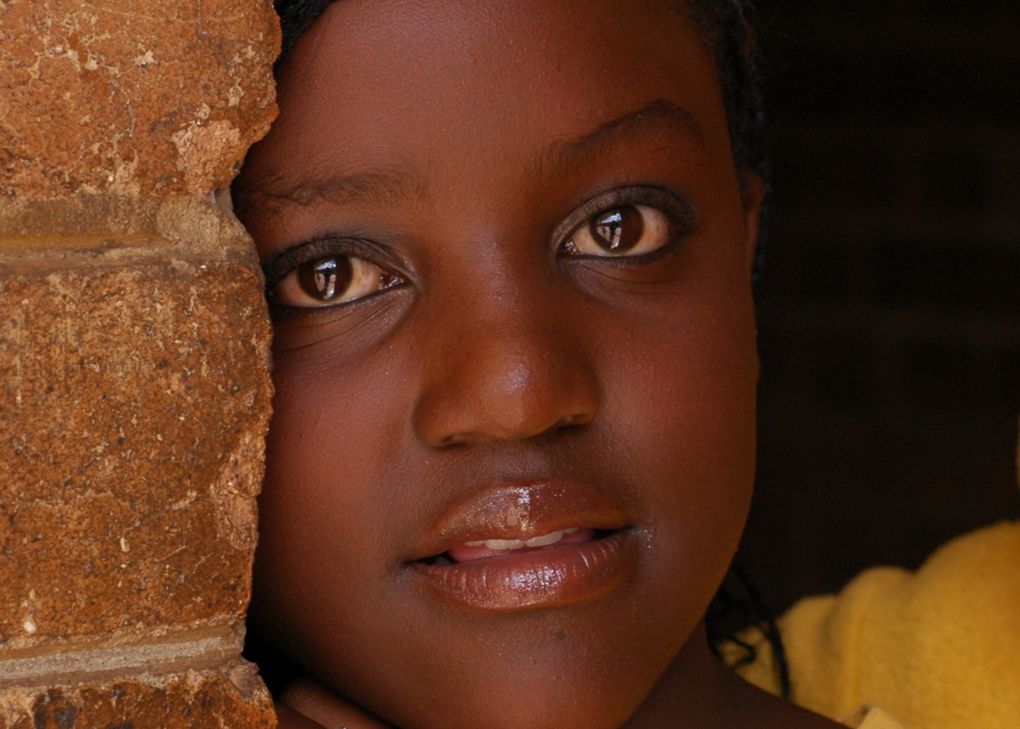 heartofgold-sickle-cell